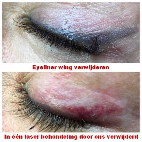 De eyeliner wing compleet verwijderen De eyeliner wing compleet verwijderen